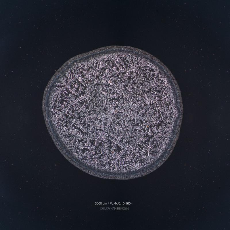 Illustration for article titled The Beautiful Secrets of Tears, Revealed By a Microscope